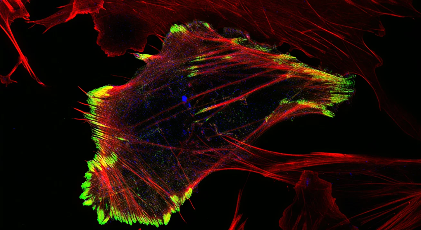 Mechanisms of Tumor Cell Migration