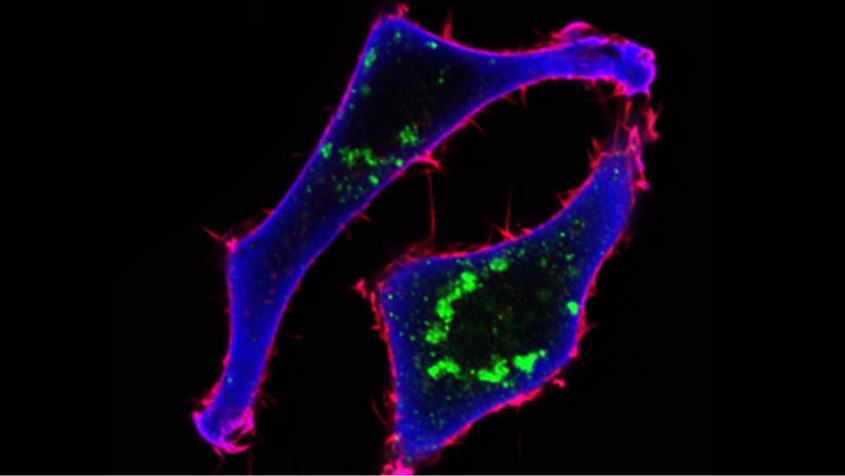 analisi dell'evoluzione dinamica dei monostrati epiteliali mammari