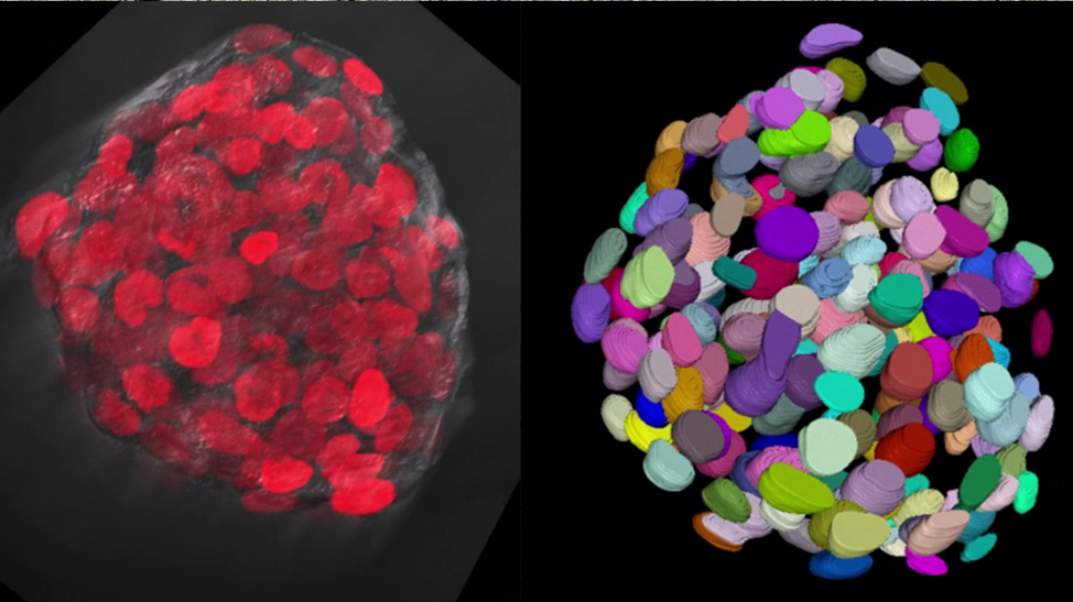 3D segmentation