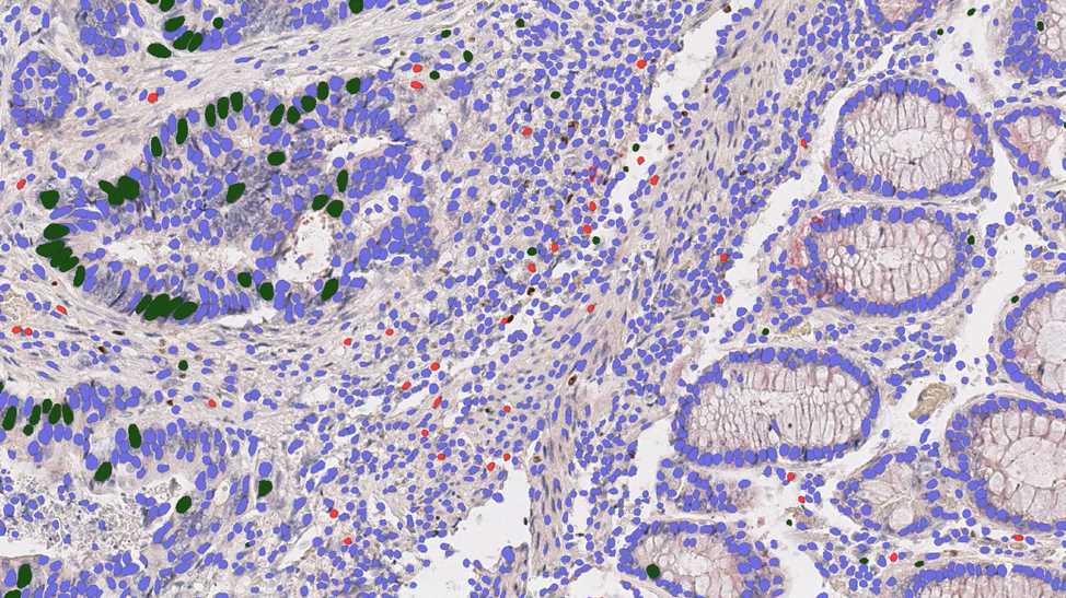 Digital pathology